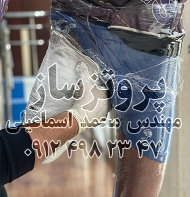 پروتزساز