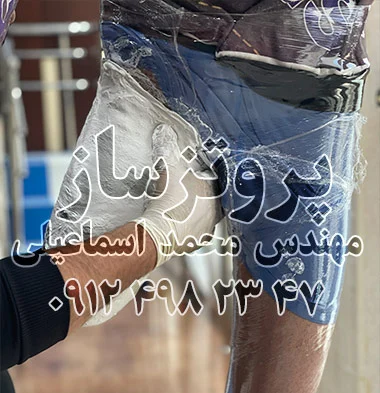 پروتزساز