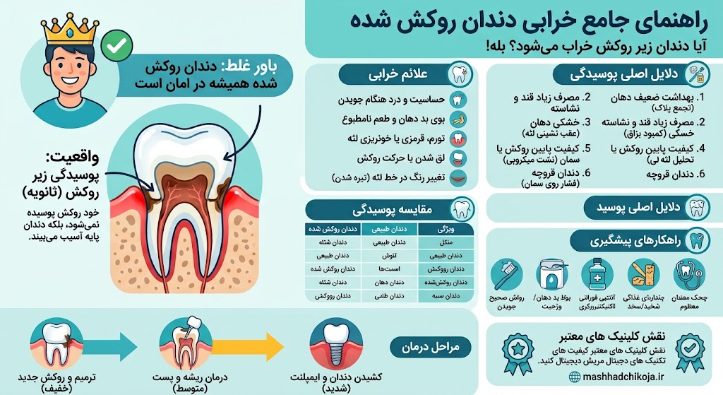دندانپزشکی | ایمپلنت آیا دندان روکش شده خراب میشود